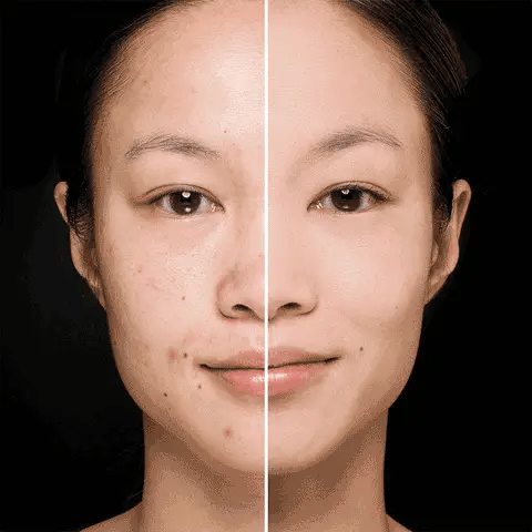 Crema Aclarante Bioqua – Elimina manchas y unifica tu piel